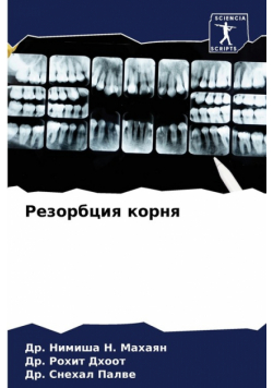 Резорбция корня