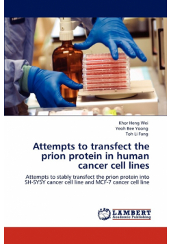 Attempts to Transfect the Prion Protein in Human Cancer Cell Lines