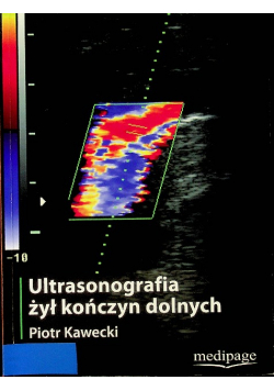 Ultrasonografia żył kończyn dolnych
