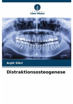 Distraktionsosteogenese