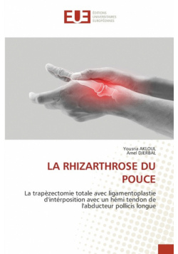 La Rhizarthrose Du Pouce