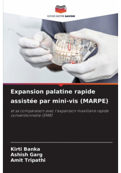 Expansion palatine rapide assistée par mini-vis (MARPE)