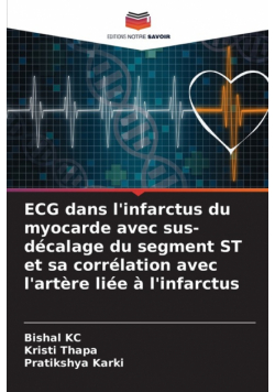 ECG dans l'infarctus du myocarde avec sus-décalage du segment ST et sa corrélation avec l'artère liée à l'infarctus