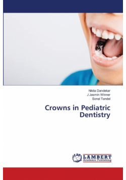 Crowns in Pediatric Dentistry