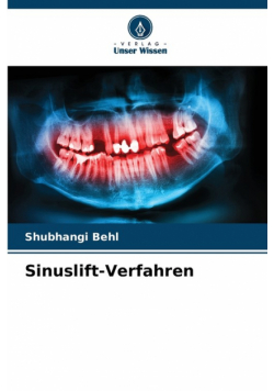 Sinuslift-Verfahren