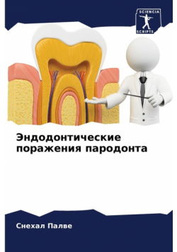 Эндодонтические поражения пародонта
