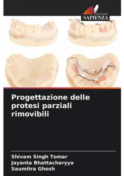 Progettazione delle protesi parziali rimovibili
