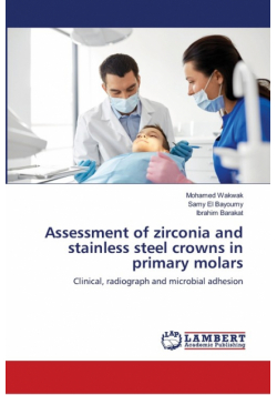 Assessment of zirconia and stainless steel crowns in primary molars
