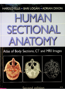 Human Sectional Anatomy Atlas of Body Sections CT and MRI Images