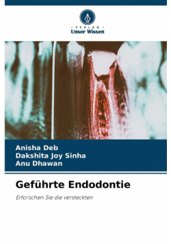 Geführte Endodontie