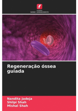 Regeneração óssea guiada