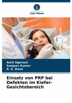 Einsatz von PRP bei Defekten im Kiefer-Gesichtsbereich