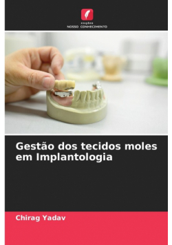 Gestão dos tecidos moles em Implantologia