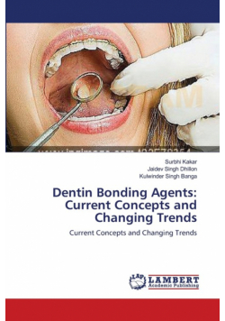 Dentin Bonding Agents