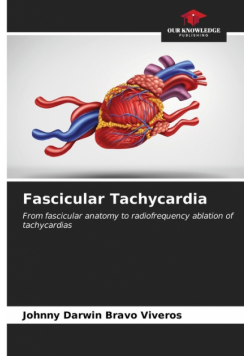 Fascicular Tachycardia