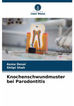 Knochenschwundmuster bei Parodontitis