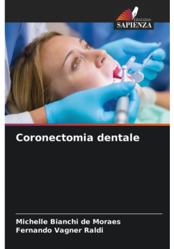 Coronectomia dentale