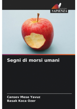 Segni di morsi umani