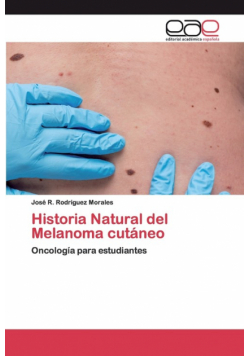 Historia Natural del Melanoma cutáneo