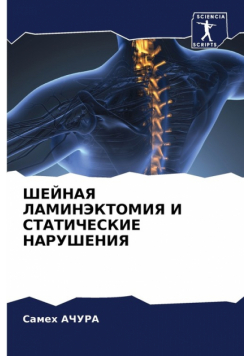 ШЕЙНАЯ ЛАМИНЭКТОМИЯ И СТАТИЧЕСКИЕ НАРУШЕНИЯ
