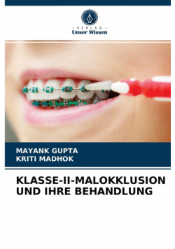 Klasse-Ii-Malokklusion Und Ihre Behandlung