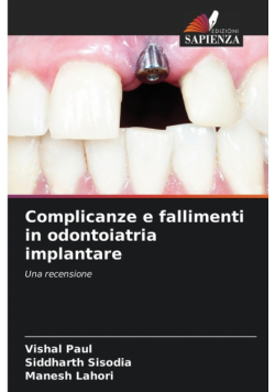 Complicanze e fallimenti in odontoiatria implantare
