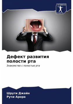 Дефект развития полости рта