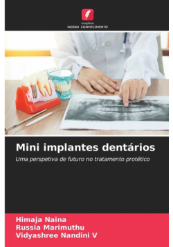 Mini implantes dentários