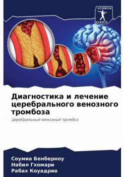 Диагностика и лечение церебрального венозного тромбоза
