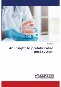 An insight to prefabricated post system