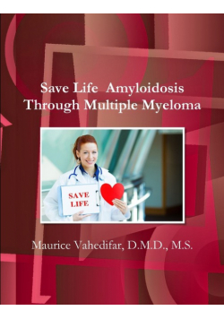Save Life  Amyloidosis Through Multiple Myeloma