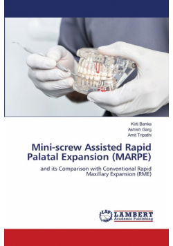 Mini-screw Assisted Rapid Palatal Expansion (MARPE)