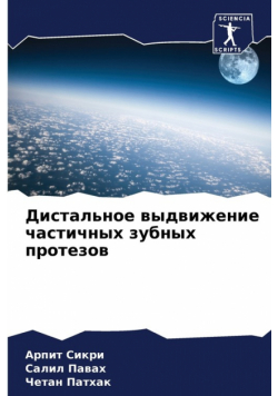 Дистальное выдвижение частичных зубных протезов