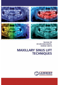Maxillary Sinus Lift Techniques