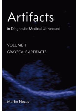 Artifacts in Diagnostic Medical Ultrasound