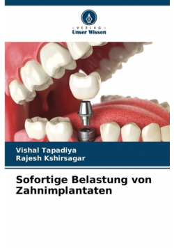 Sofortige Belastung von Zahnimplantaten