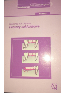 Protezy szkieletowe
