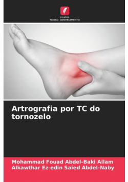 Artrografia por TC do tornozelo