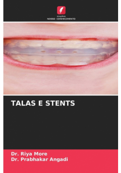 Talas E Stents