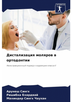 Дистализация моляров в ортодонтии