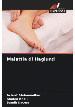 Malattia di Haglund