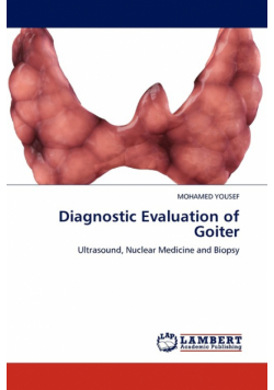 Diagnostic Evaluation of Goiter