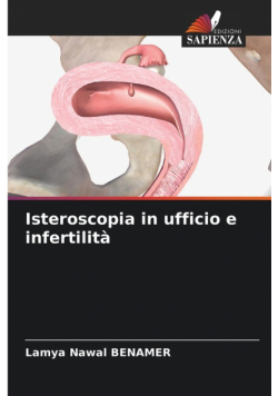 Isteroscopia in ufficio e infertilità