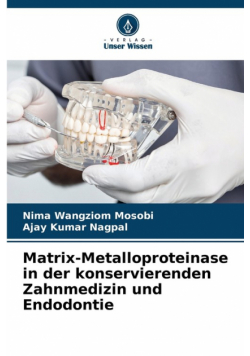 Matrix-Metalloproteinase in der konservierenden Zahnmedizin und Endodontie