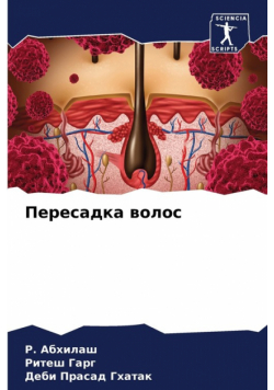 Пересадка волос