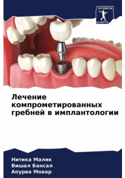 Лечение компрометированных гребней в имплантологии