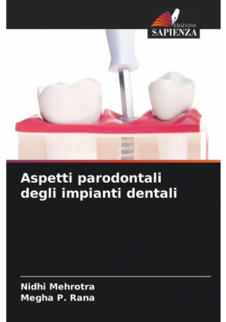 Aspetti parodontali degli impianti dentali