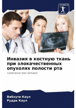 Инвазия в костную ткань при злокачественных опухолях полости рта