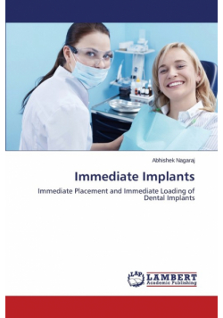 Immediate Implants
