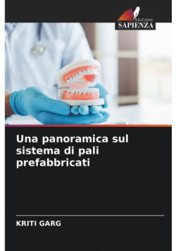 Una panoramica sul sistema di pali prefabbricati